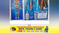 Punya Keluhan Mata, Tulang atau Sendi? Jhoni Khan Buka Konsultasi Pengobatan Herbal di Makassar
