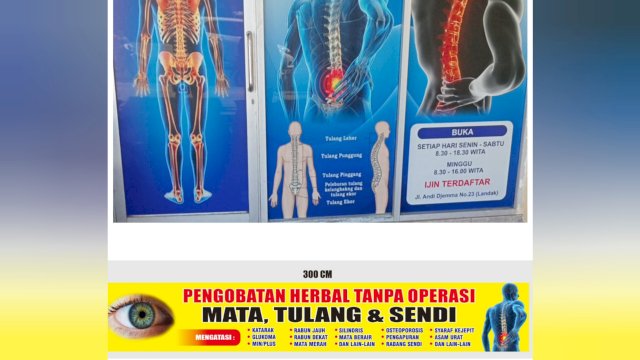 Layanan pengobatan herbal di Makassar.