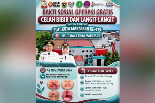HUT ke-419 Makassar, RSUD Daya Hadirkan Operasi Celah Bibir dan Langit-Langit Gratis